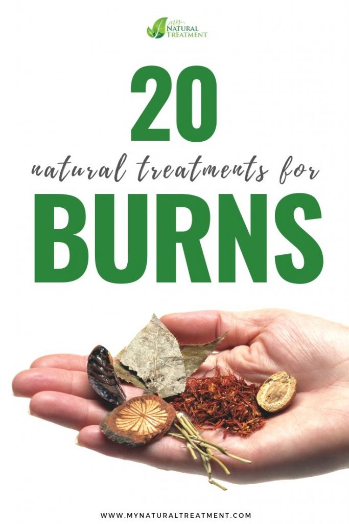 Natural Treatments for Burns