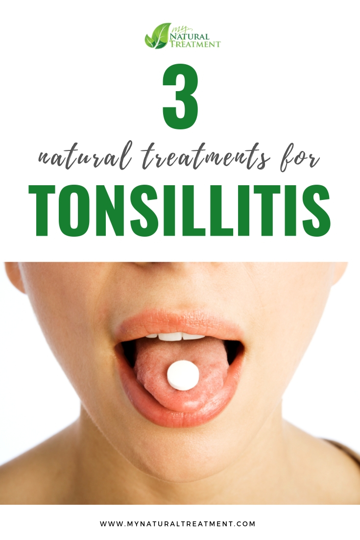 3 Best Natural Treatments for Tonsillitis|Tonsillitis Remedy