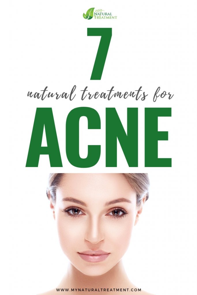 Natural Treatments for Acne that Work
