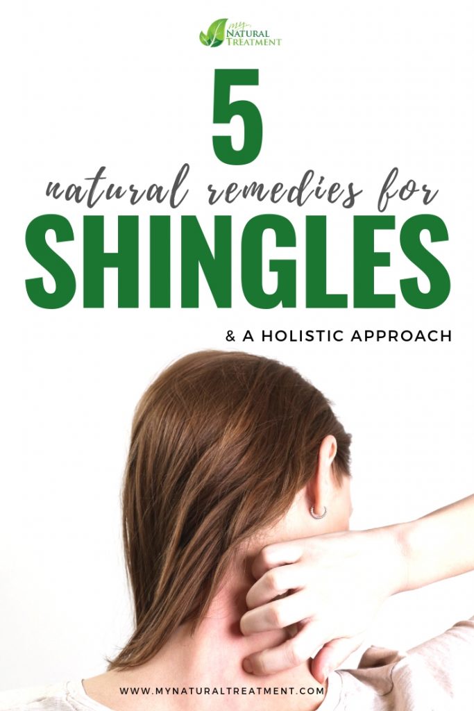 5 Natural Remedies for Shingles & A Holistic Approach