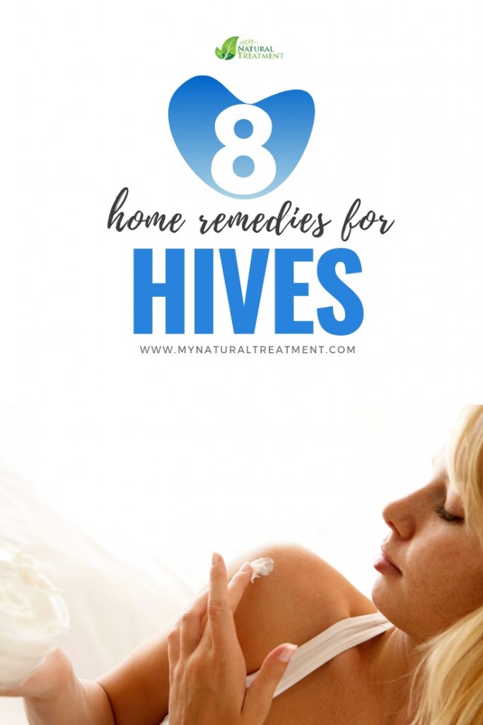 8 Natural Remedies for Hives - MyNaturalTreatment.com