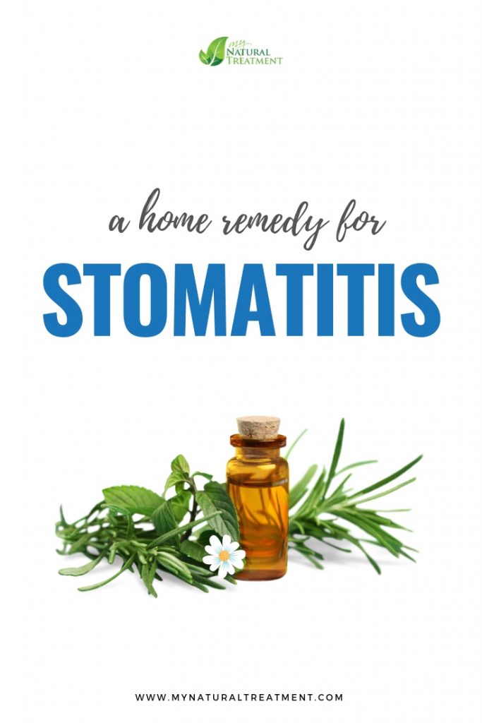 Stomatitis Home Remedy