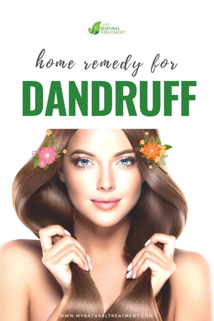 Home Remedy for Dandruff with Honey