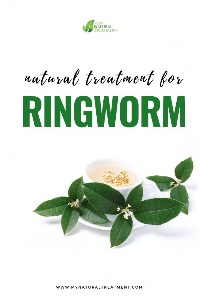 Natural Treatment for Ringworm in Humans