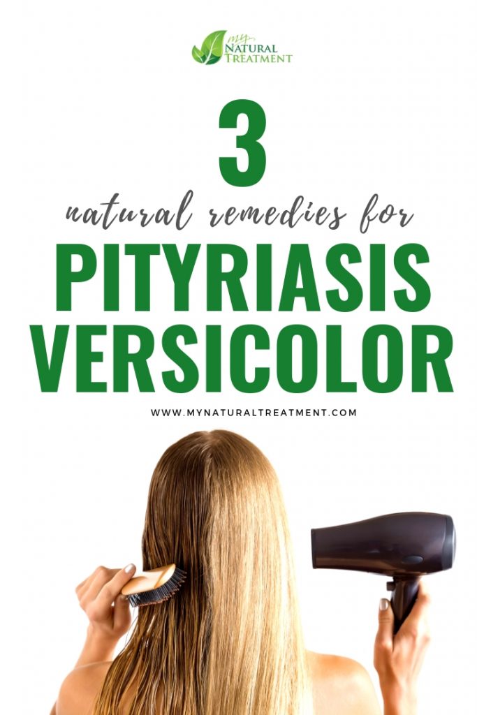 3 Natural Remedies for Pityriasis Versicolor