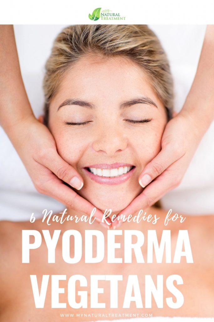 6 Natural Remedies for Pyoderma Vegetans - MyNaturalTreatment.com