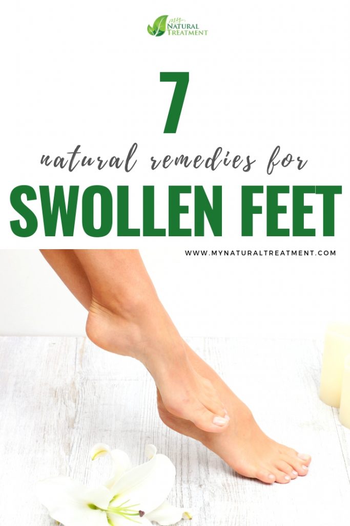 Natural remedies for swollen feet