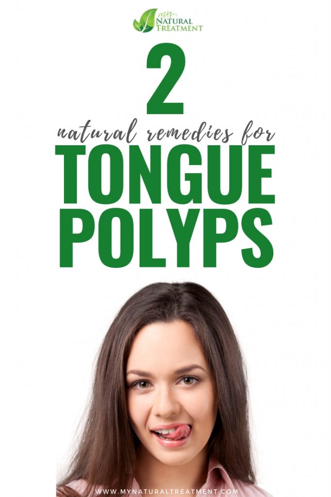 2 Natural Remedies for Tongue Polyps