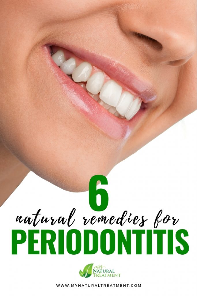 6 Natural Remedies for Periodontitis