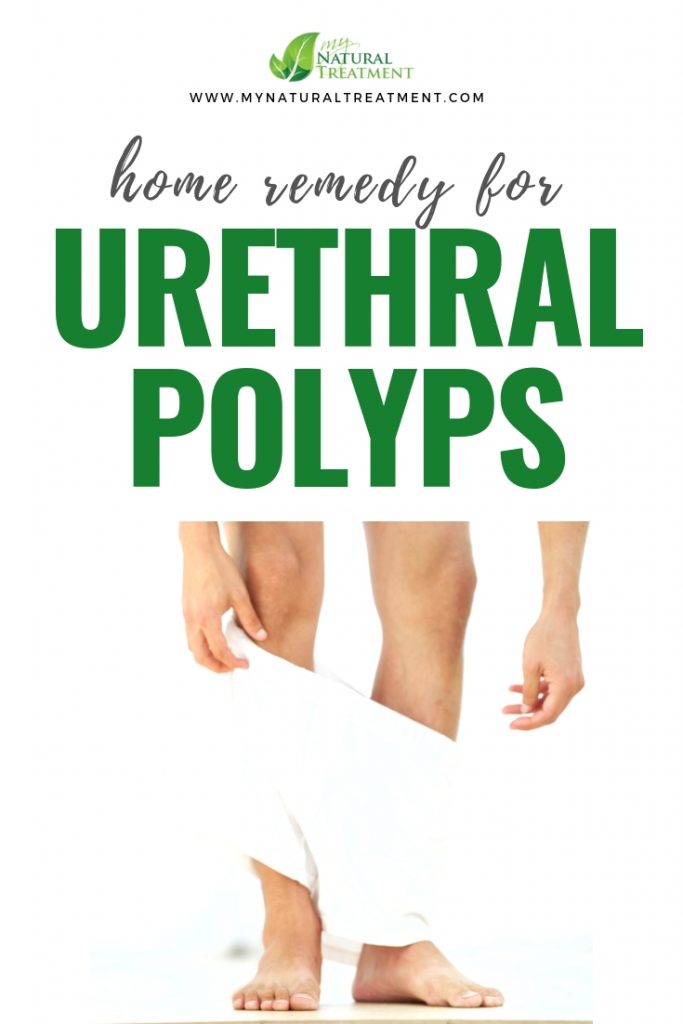 Home Remedy for Urethral Polyps