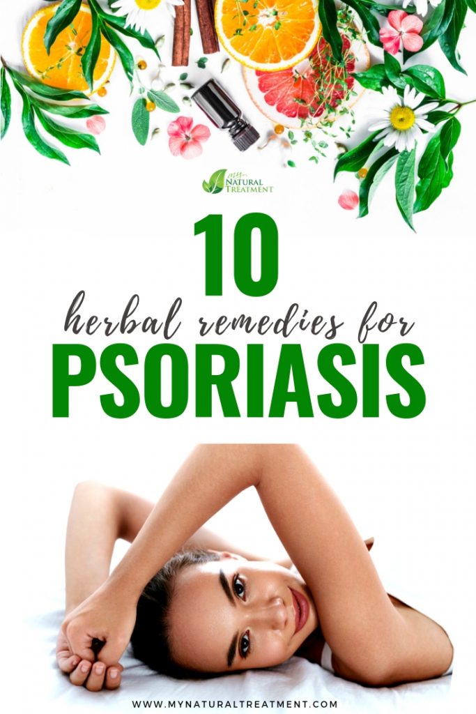 10 Herbal Remedies that Heal Psoriasis
