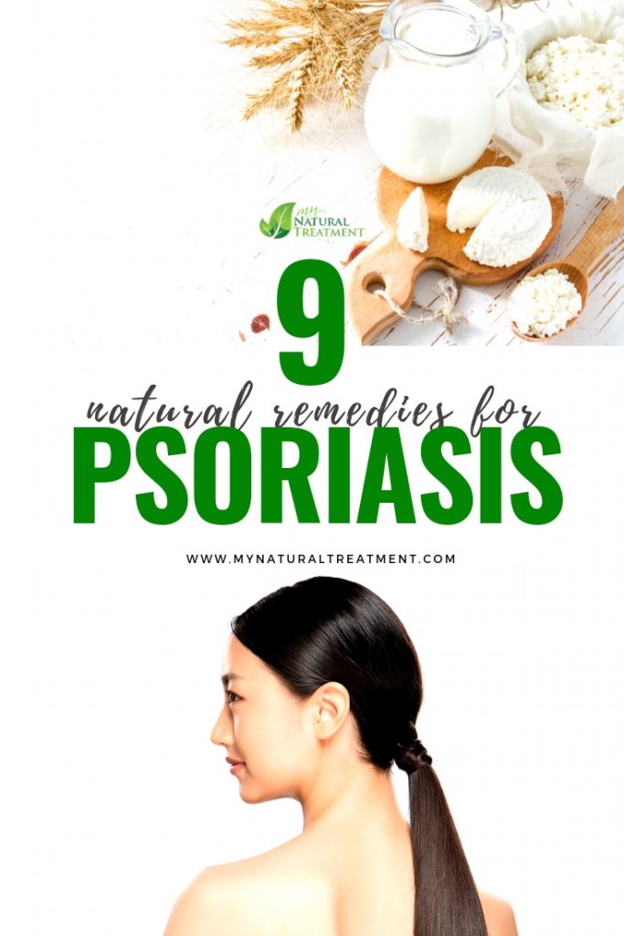 Best natural remedies for psoriasis