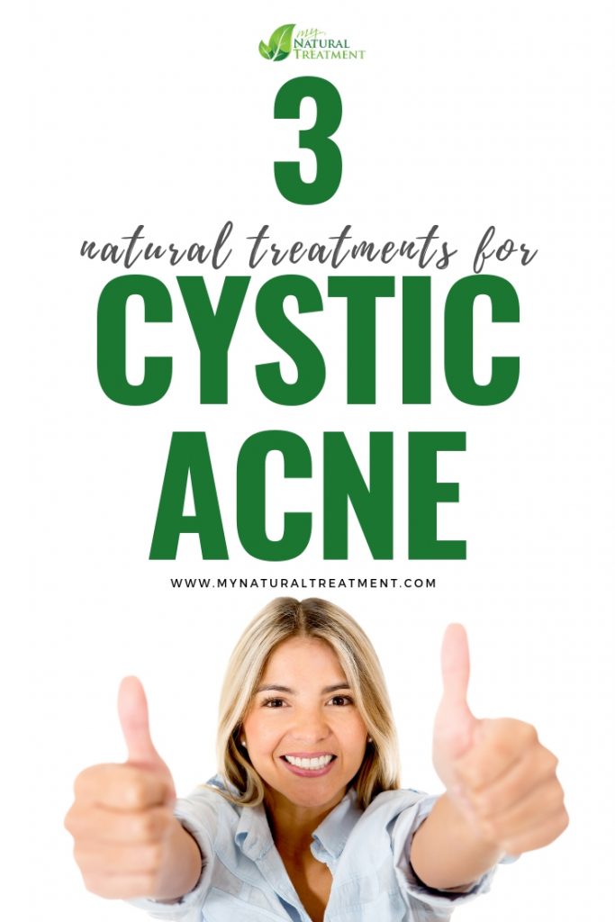 Natural Treatments for Cystic Acne