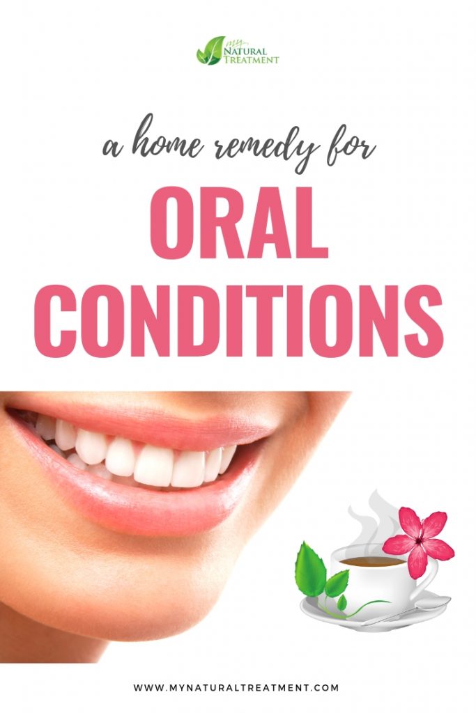 Oral Conditions Home Remedy