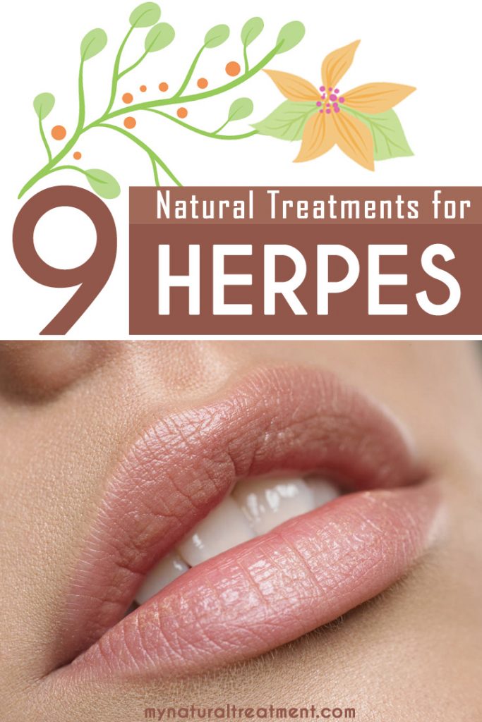 9 Amazing Natural Treatments for Herpes that you can try at home