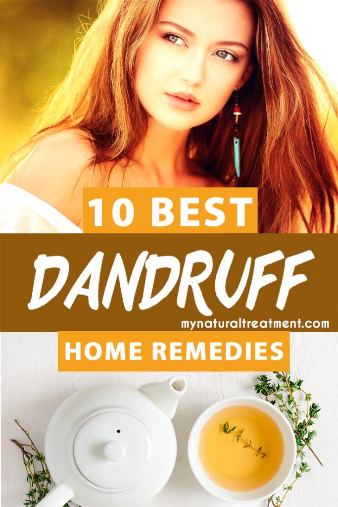 10 Best Home Remedies for Dandruff