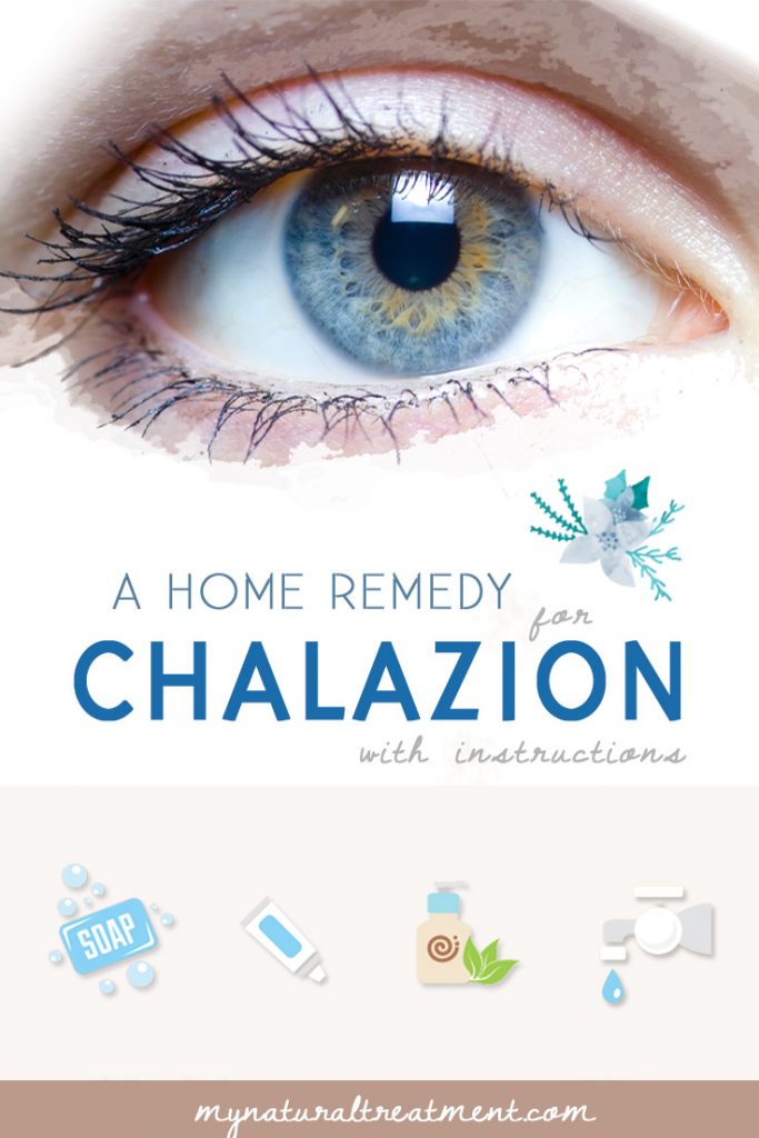 Home Remedy for Chalazion that Works #chalazion #chalazionremedy