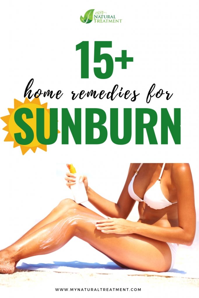 15+ Home Remedies for Sunburn