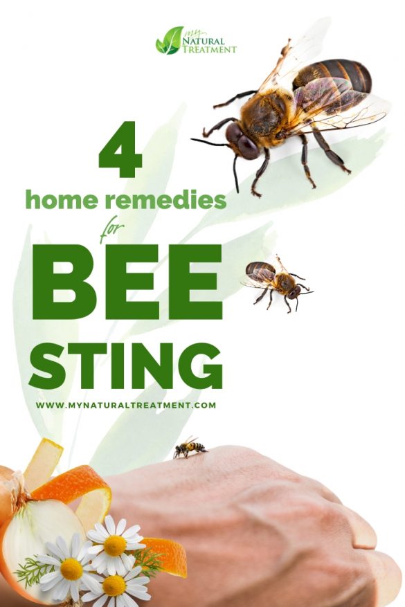 bee sting remedy joint
