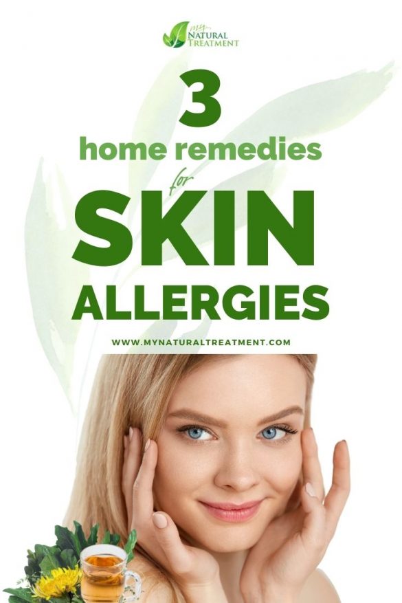 3 Powerful Home Remedies For Skin Allergies Rashes 