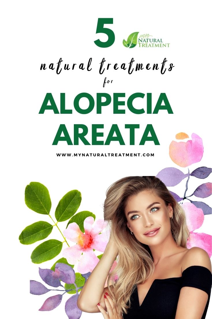 5 Natural Treatments For Alopecia Areata 