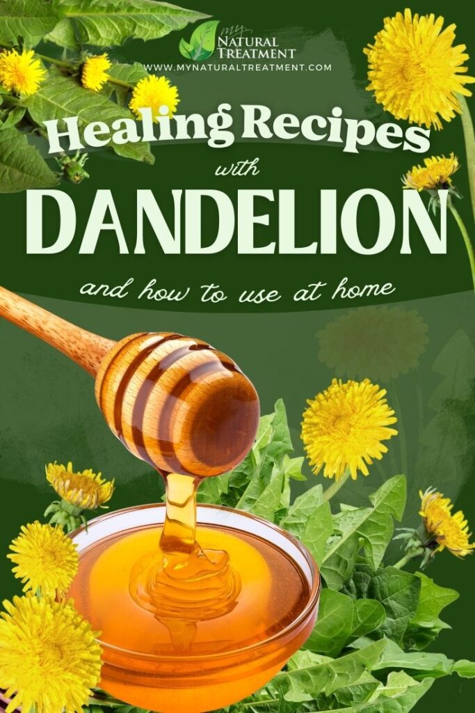 3 Healing Dandelion Recipes and How to Use at Home - MyNaturalTreatment.com