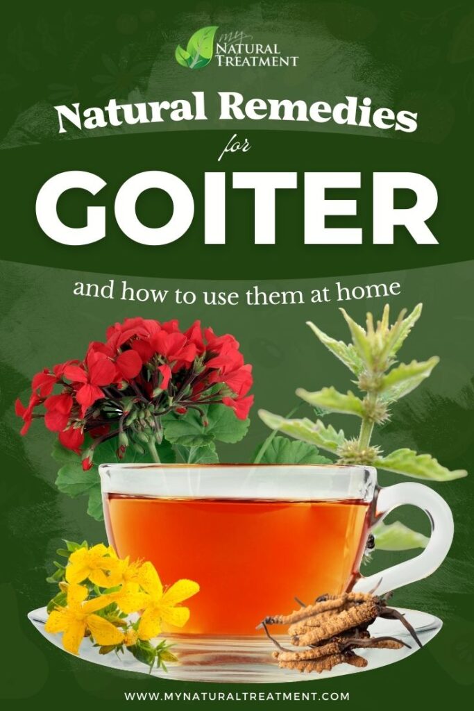 Most Powerful Natural Remedies for Goiter - MyNaturalTreatment.com