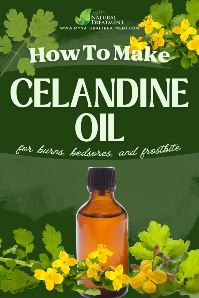 How to Harvest Celandine - How to Make Celandine Oil Uses - Celandine Oil Recipe - MyNaturalTreatment.com