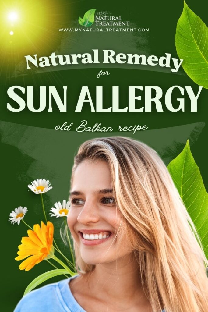 Powerful Natural Remedy for Sun Allergy - Sun Allergy Remedy - Sun Allergy Remedies - MyNaturalTreatment.com