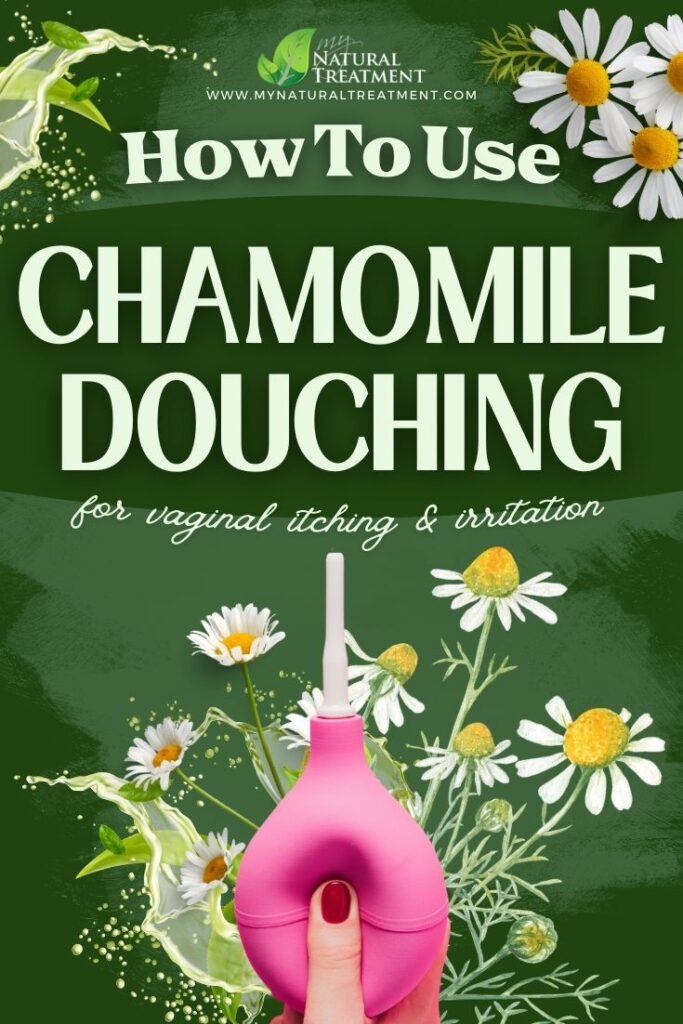 How to Use Chamomile Douching for Vaginal Itching - MyNaturalTreatment.com