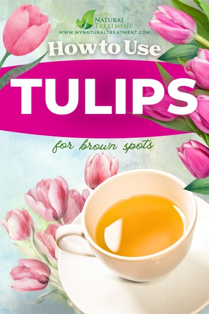 How to Use Tulips for Brown Spots - Tulip Uses - Tulip Remedies - MyNaturalTreatment.com